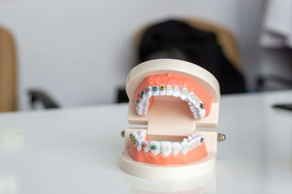 A plastic model of a set of teeth with braces.