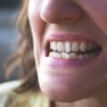 A close-up of he mouth of a woman with crooked teeth.